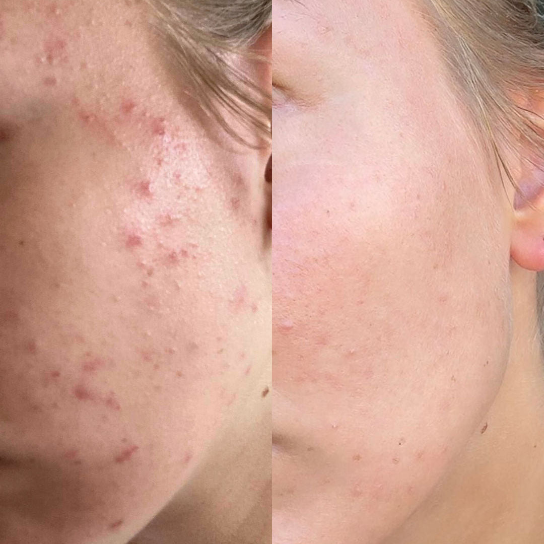 LUNÁ Premium Pillow Case - Baby Pink